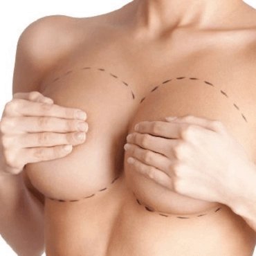 Brustoperation für symmetrische Brüste