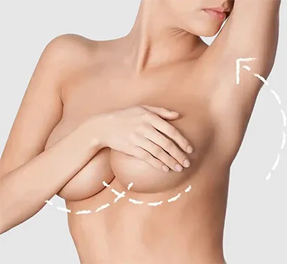 Endoskopische Brustvergrößerungen in München